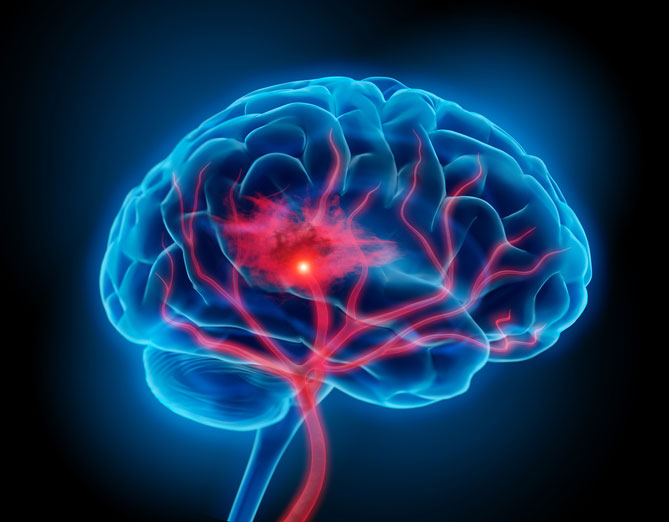 3D rendering of a brain with nerves
