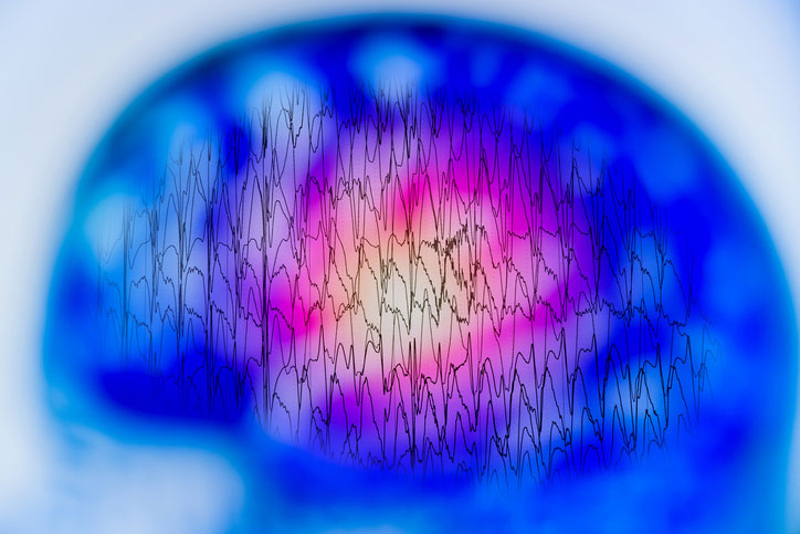 Brain scan with waves